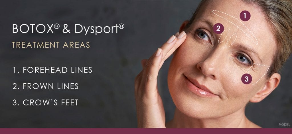 Botox and Dysport treatment areas feature